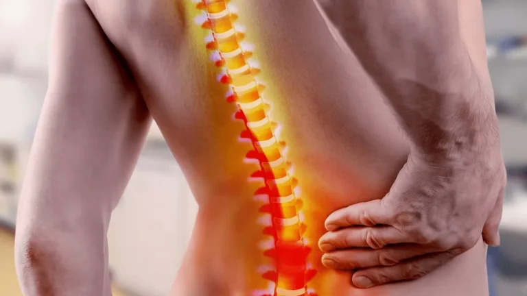 Vertèbre déplacée