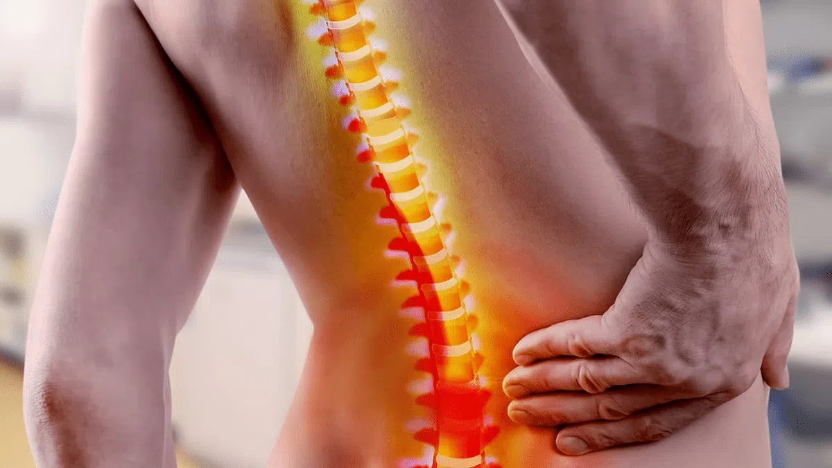 Vertèbre déplacée